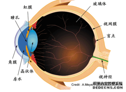 義眼適合什么樣的患者？